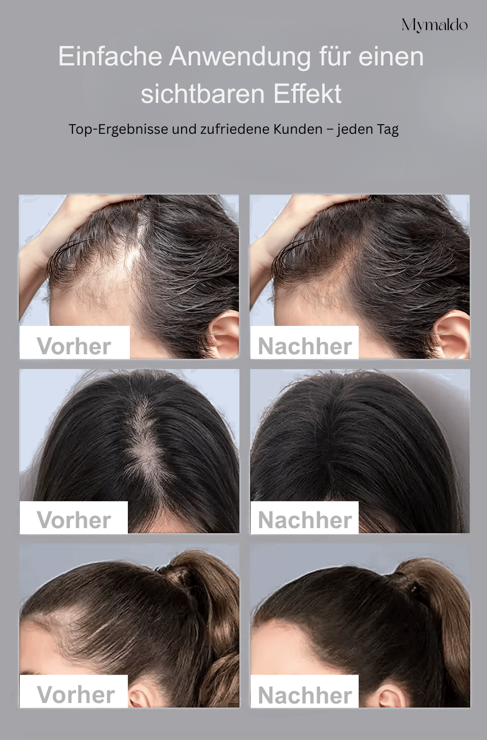 Perfekter Haaransatz in Sekunden